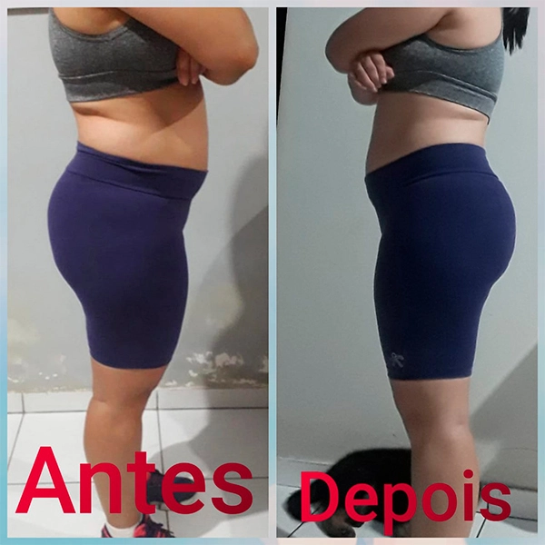 corpo antes e depois de emagrecer rapido com o melhor suplemento