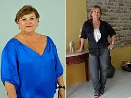 antes e depois de uma senhora que emagreceu na menopausa
